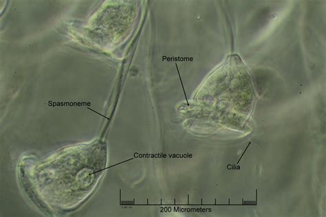  Vorticella! Eine winzige Wirbelwirtin, die Wasserströmungen mit Anmut nutzt