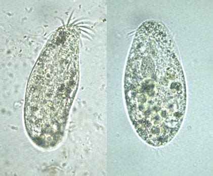  Oxytrichidae: Ein Meister der Zellteilung, der selbst den geschicktesten Mikroskopiker zum Staunen bringt!